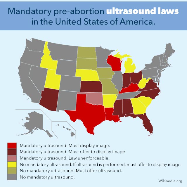 Abortion Infographic